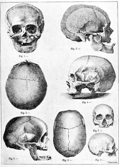 Figs 13 Kants Skull 4 Voltas Skull Figs 56 Fusinieris Skull - фото 1