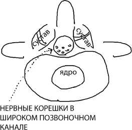 Рис 9 Рис 10 На магнитнорезонансной томографии МРТ сужение канала может - фото 10