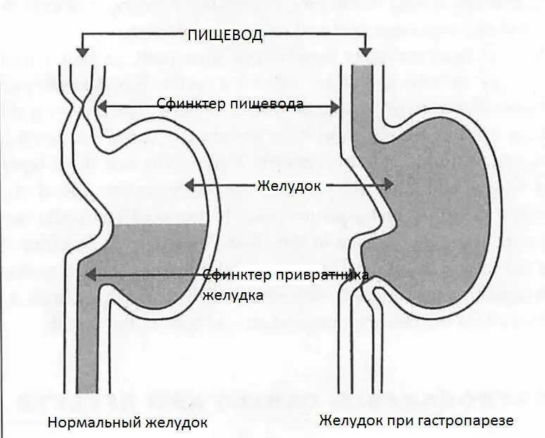 Рисунок 421 Изза того что желудок опорожняется медленно даже небольшое - фото 13
