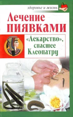Николай Крамский Лечение пиявками. «Лекарство», спасшее Клеопатру обложка книги