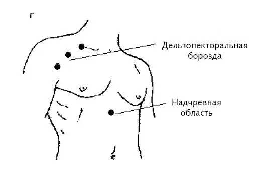 Рис 1 в г Массаж для укрепления сердечной мышцы Кардионевротические - фото 11