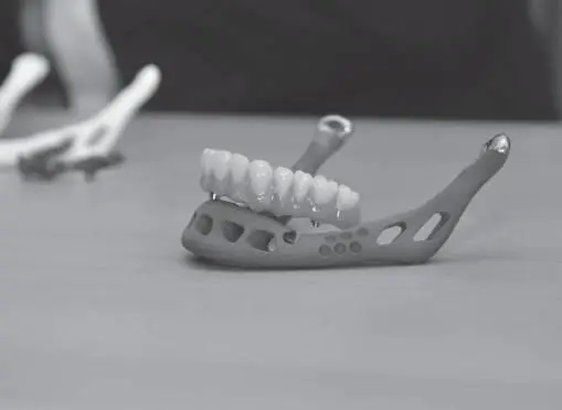 Искусственная челюсть напечатанная на 3Dпринтере Кажется пора приступать к - фото 61