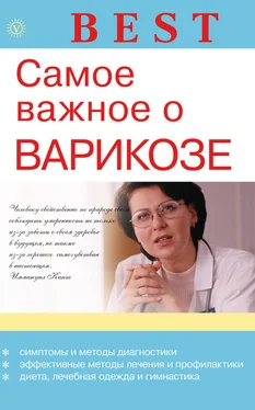 Ирина Малышева Самое важное о варикозе обложка книги