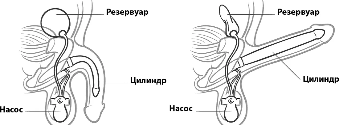 Могут ли стимулирующие лекарственные средства вернуть полноценную сексуальную - фото 79