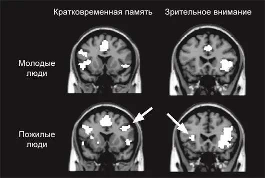Рис 14 Пожилые люди используют правое и левое полушария более равномерно - фото 14