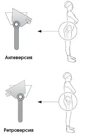 Тазобедренный сустав как и остальные суставы тела позволяет одной из двух - фото 76