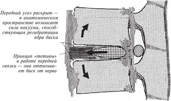 Рис 33 На этой схеме показан эффект раскрытия переднего корректирующего - фото 53