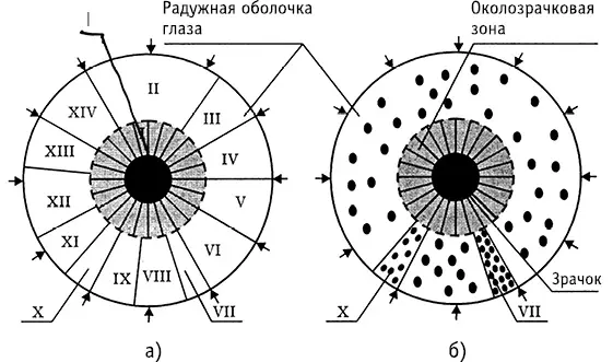 Рис 1Схематическая карта радужной оболочки глаза при иридодиагностике а - фото 3