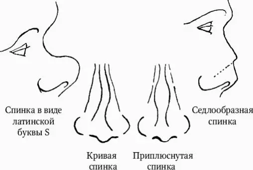 Глаза Глаза рассматриваются в отношении цвета и особенностей Точное - фото 17