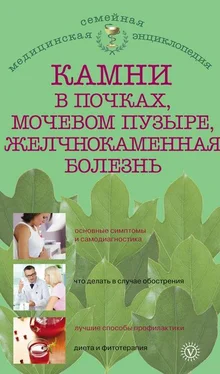 Александра Васильева Камни в почках, мочевом пузыре, желчнокаменная болезнь обложка книги