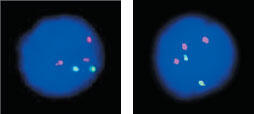 Флуоресцентный тест может определить пол плода и нарушения в количестве - фото 175