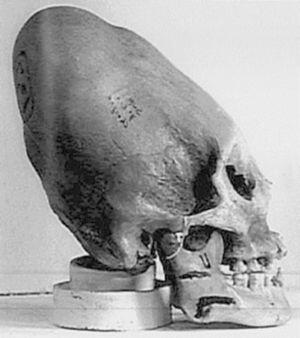 Загадочный череп из Перу И вот новое открытие дающее основание как раз для - фото 3