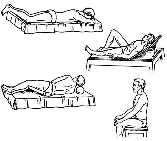 Рис 7 Положения пациента при проведении массажа В массажном кабинете должна - фото 10