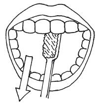 рис 4 Чистка начинается с наружных поверхностей передних и боковых зубов от - фото 8