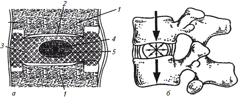 Рис 6 Межпозвонковый диск а схема строения 1 тело позвонка 2 - фото 7