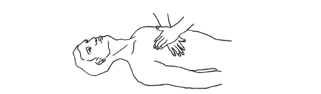 Рисунок 6 Непрямой массаж сердца Надавливает на грудину достаточно сильно - фото 6
