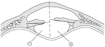 Рис 4 Механизм аккомодации Рис 5 Схема рефракции глаза При близорукости - фото 4