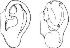 Рис 1 Сходство формы уха с эмбрионом человека В человеческом теле - фото 2