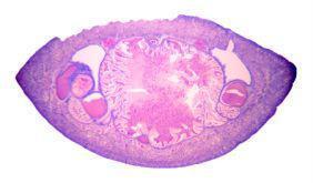 1 Brain Parasites There are certain parasites capable of possessing the - фото 2