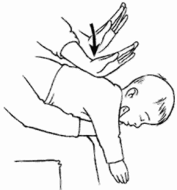 Переверните ребенка на спину Основание ладони поместите на грудину посередине - фото 24