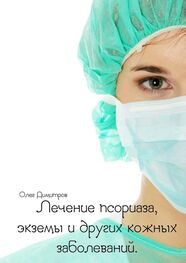 Олег Димитров: Лечение псориаза, экземы и других кожных заболеваний
