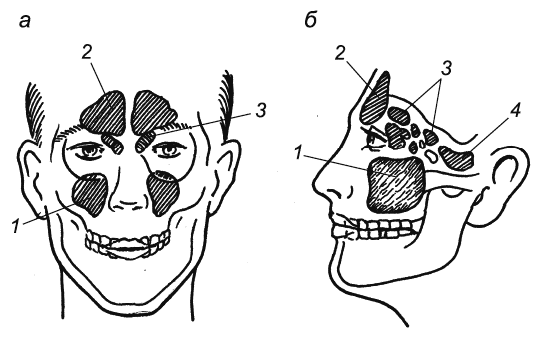 Рис 6 Расположение околоносовых пазух в голове человека схема а вид - фото 6