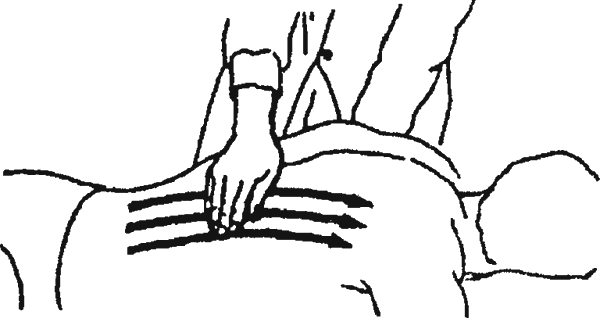 Рис 14 Поперечное выжимание на спине Выжимание на шее и трапециевидных - фото 14