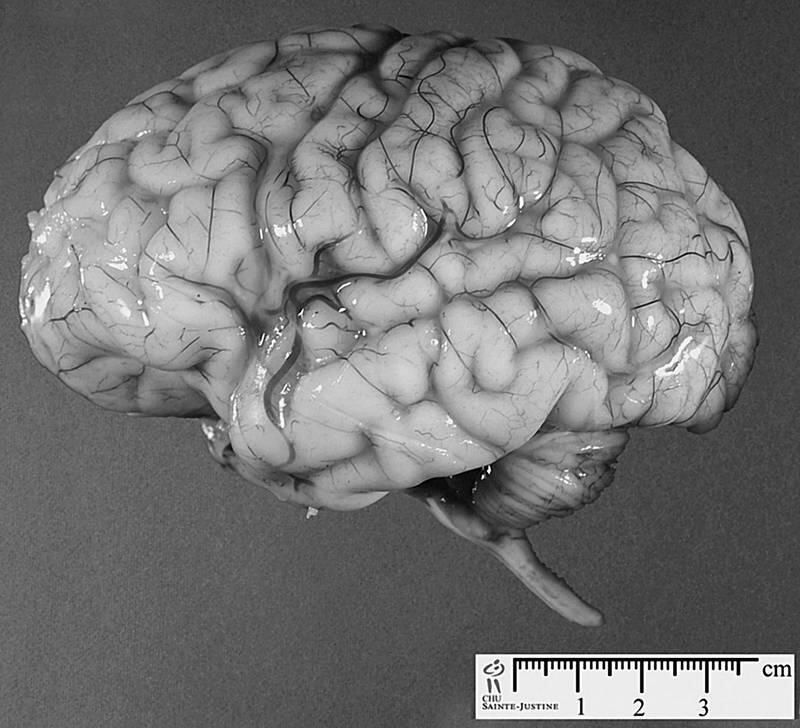 Мозг мужчины отличается от мозга женщины Так например у женщин лучше чем у - фото 5
