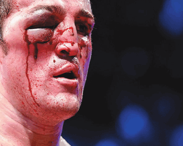 Смерть на ринге Криминальные сюжеты из жизни профессионального бокса - фото 52