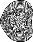 Рис 4 Межпозвонковый диск Спереди и с боков фиброзное кольцо фиксировано к - фото 4