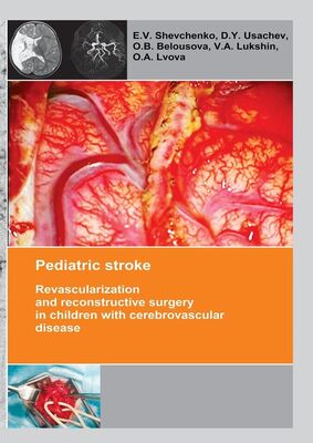 O. Belousova Pediatric stroke. Revascularization and reconstructive surgery in children with cerebrovascular disease
