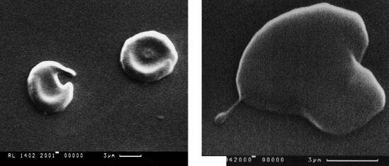 Микрофотографии 1 2 Показаны несовершенные грибы формирование ими - фото 1