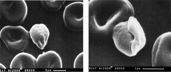Микрофотографии 3 4 Диатомовая водоросль На ее поверхности наблюдается шов - фото 2