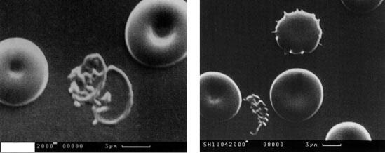 Микрофотографии 7 8 Хищные несовершенные грибы выявленные при раковом - фото 4