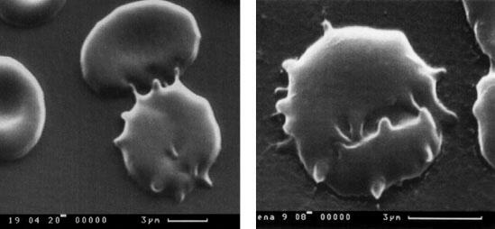Микрофотографии 11 12 Слева показано нападение хищного несовершенного гриба - фото 6