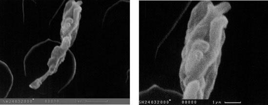 Микрофотографии 13 14 Споры хищного несовершенного гриба в конидиеносце на - фото 7